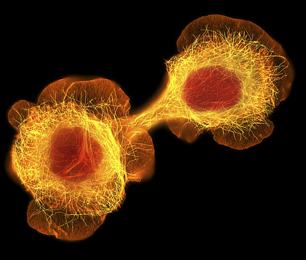 hacat-culture-cells-light-micrograph-dr-torsten-wittmann